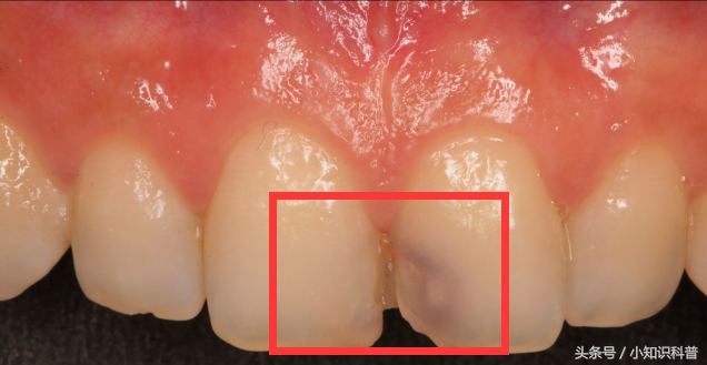 һǰȣô޸ݵİ