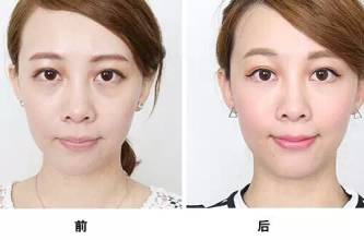 Ƶ۴ŶǮ,۸,۴Ч